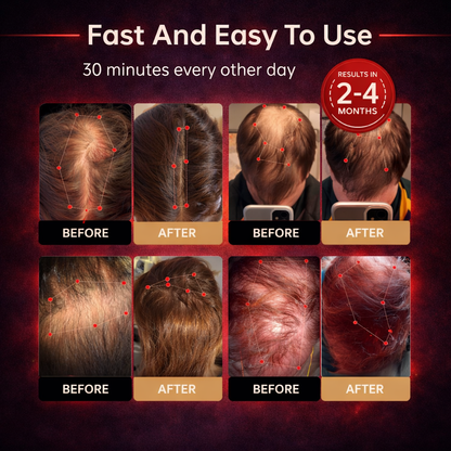 Zenvoria™ RedGlow Cap – Revives Hair from the Roots